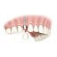Implantes dentais com carga imediata! Implantes dentais com carga imediata!