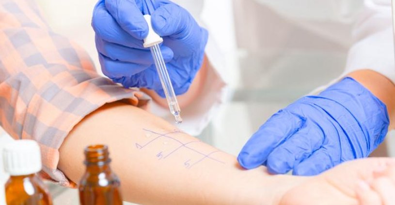 PRICK TEST - O que é? PRICK TEST - O que é?